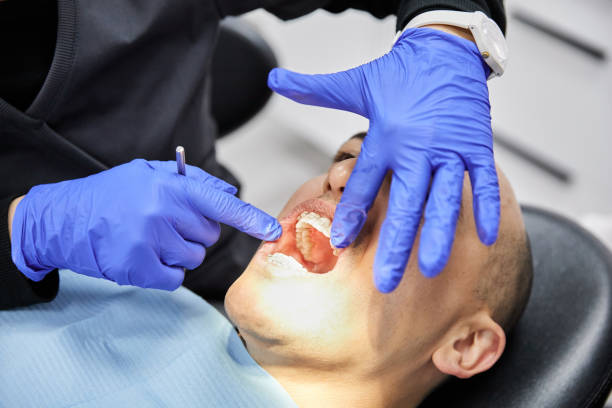 Best Emergency Denture Repair in St James, MO